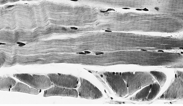 Muscle tissues